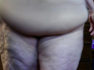 Saddlebag and cellulite 9 of 17