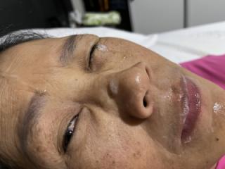 Last Night’s Facial 19 of 20