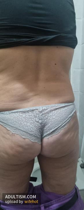 Image 2 of 11