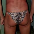Tan lines