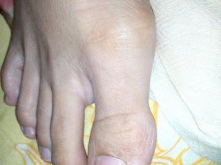 My long toes-malay 7 of 20