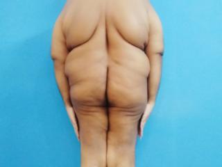 Nude Fat Man 6 of 6