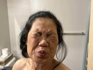 Post Facial Cleanup 6 of 7
