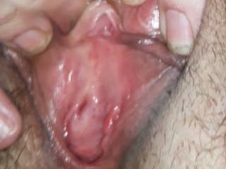 You have to open yourself up, said the psychiatrist...probably this is not what he meant. 2 of 4