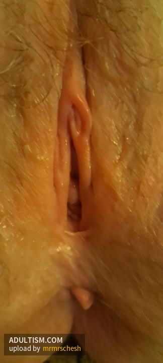 Image 2 of 5