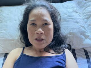 Blue Shirt Facial 1 of 20