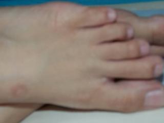 My feet and toes... 15 of 20