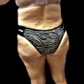Zebra Panty Day