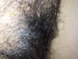 Am I too hairy 2 of 4