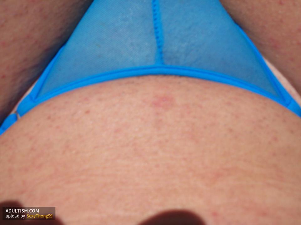 Image 1 of 14