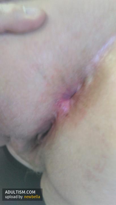 Image 7 of 8