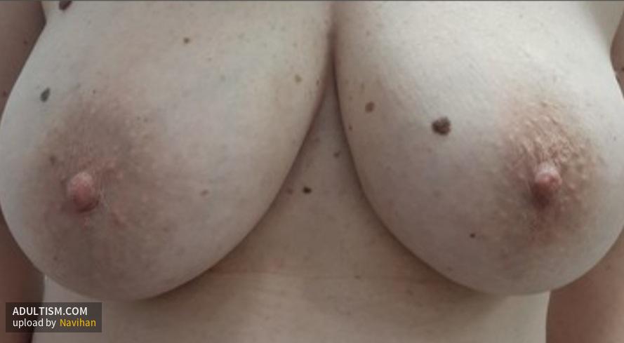 Image 2 of 4
