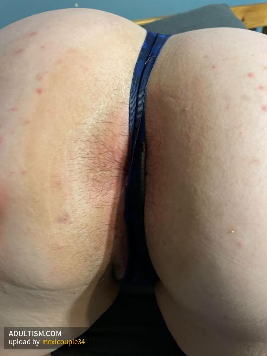 Image 5 of 20