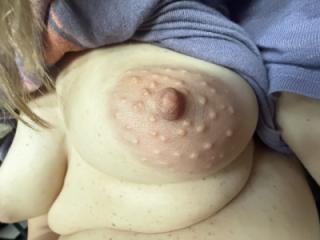 Swollen 1 of 4