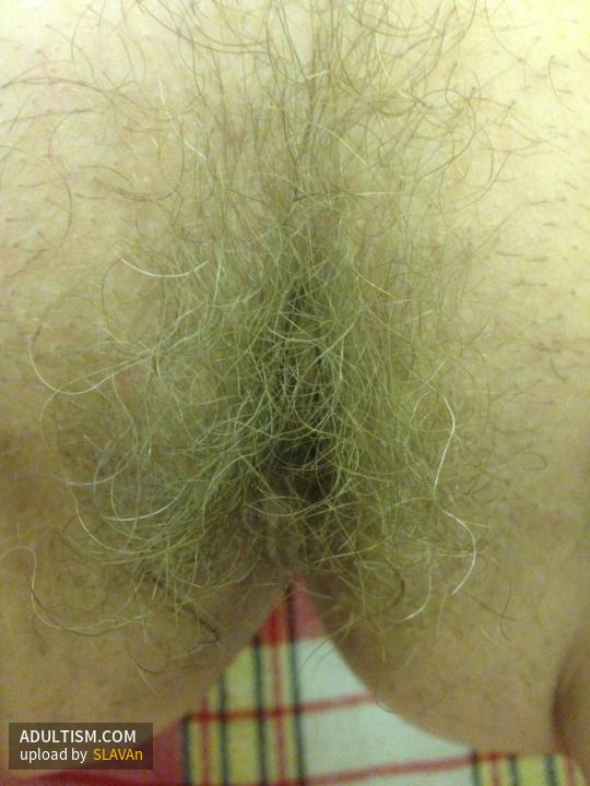 Image 2 of 10
