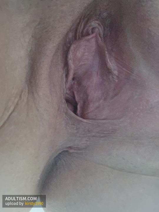 Image 2 of 11