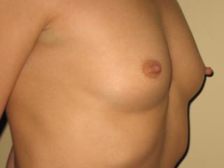 My long hard nipples! 1 of 5