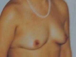 tits 3