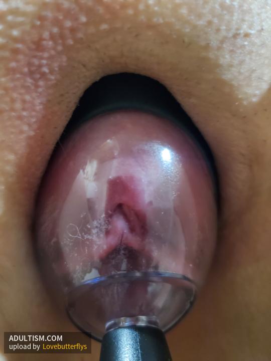Image 3 of 10