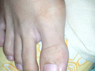 My long toes-malay 6 of 20