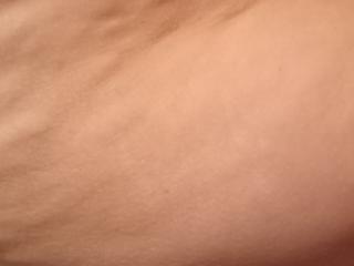 Wife cellulite 4 of 6