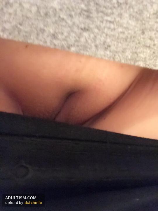 Image 1 of 11