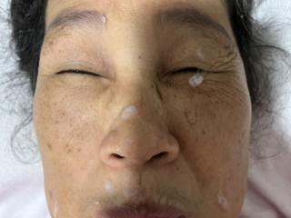 More Of Last Night’s Facial 14 of 16