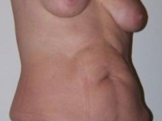 Suckable Tits 1 of 20