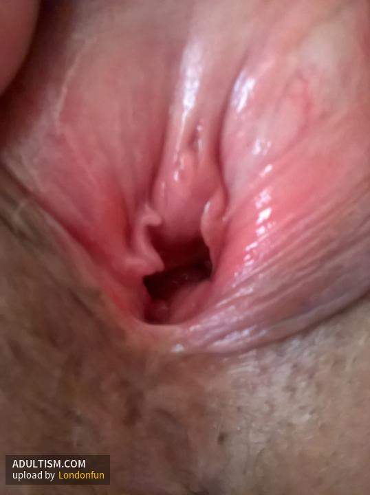 Image 2 of 6
