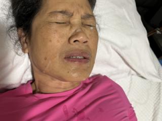 More Of Last Night’s Facial 1 of 16