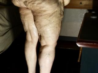 Cellulite, any one? 2 of 16