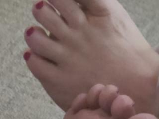 More red toes and soles 1 of 6