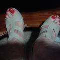 My red toenails