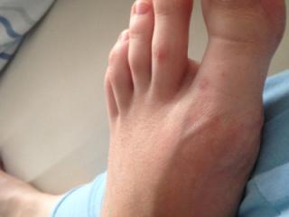 Big Toe Love