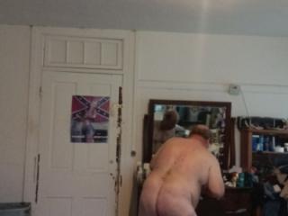 61old what hurt knee looks like other pics 4 of 8