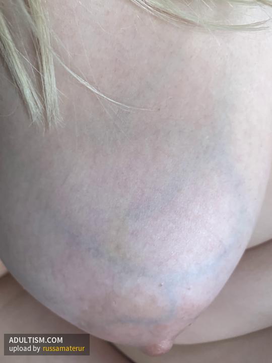 Image 2 of 20