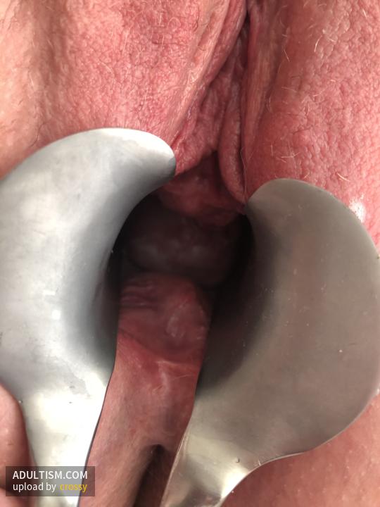 Image 4 of 20