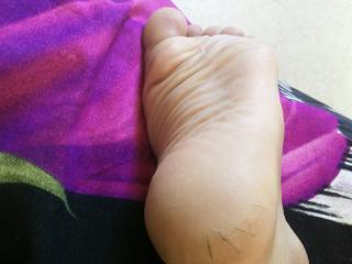 My dry,rough cracked heel