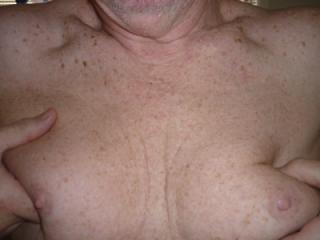 man boobs 3 of 4