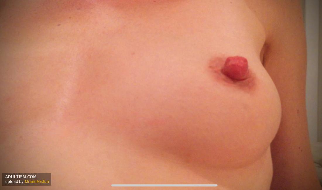 Image 3 of 5