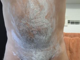 Hair removal