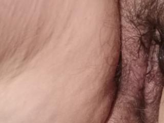 Wife cellulite 1 of 6