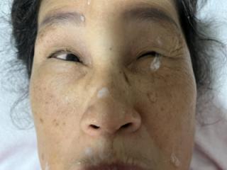 More Of Last Night’s Facial 15 of 16