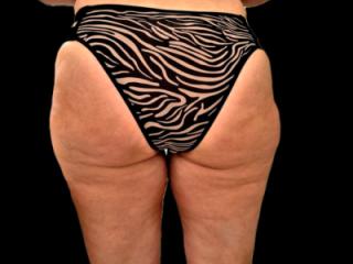 Zebra Panty Day 8 of 10
