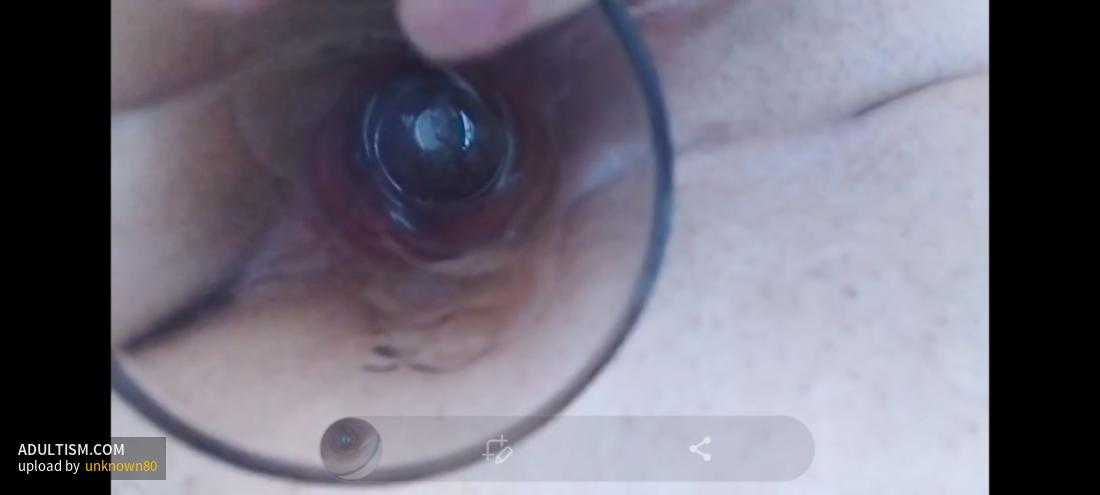 Image 4 of 6
