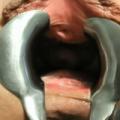 How I stretch with my speculum
