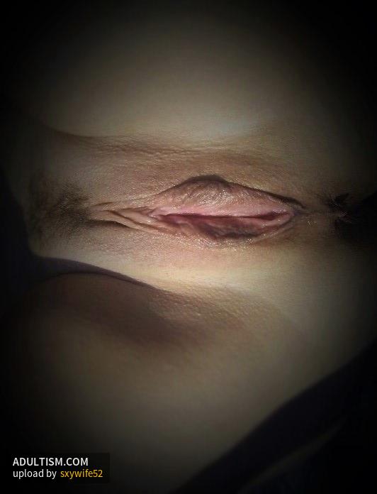 Image 2 of 10