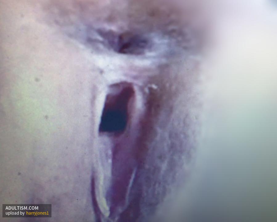 Image 4 of 11