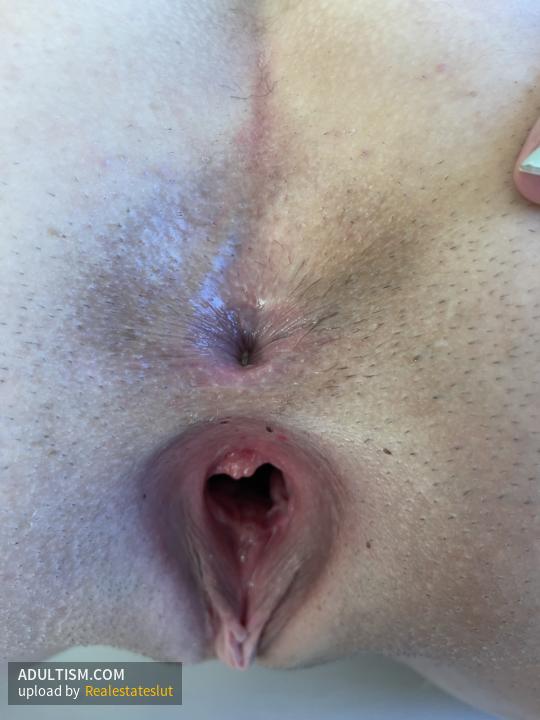 Image 5 of 20