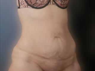 Handle bar hips 3 of 11